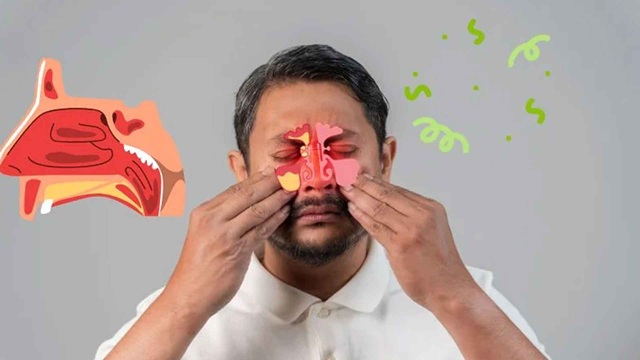 শীতে বাড়ে সাইনাসের ব্যথা, কমানোর ঘরোয়া উপায় জানুন