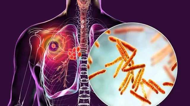 প্রতীকী ছবি